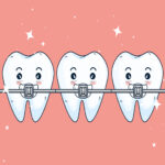 Dental Braces image