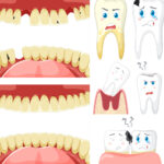 Tooth and gums image