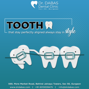 Dental Braces - Dr Dabas