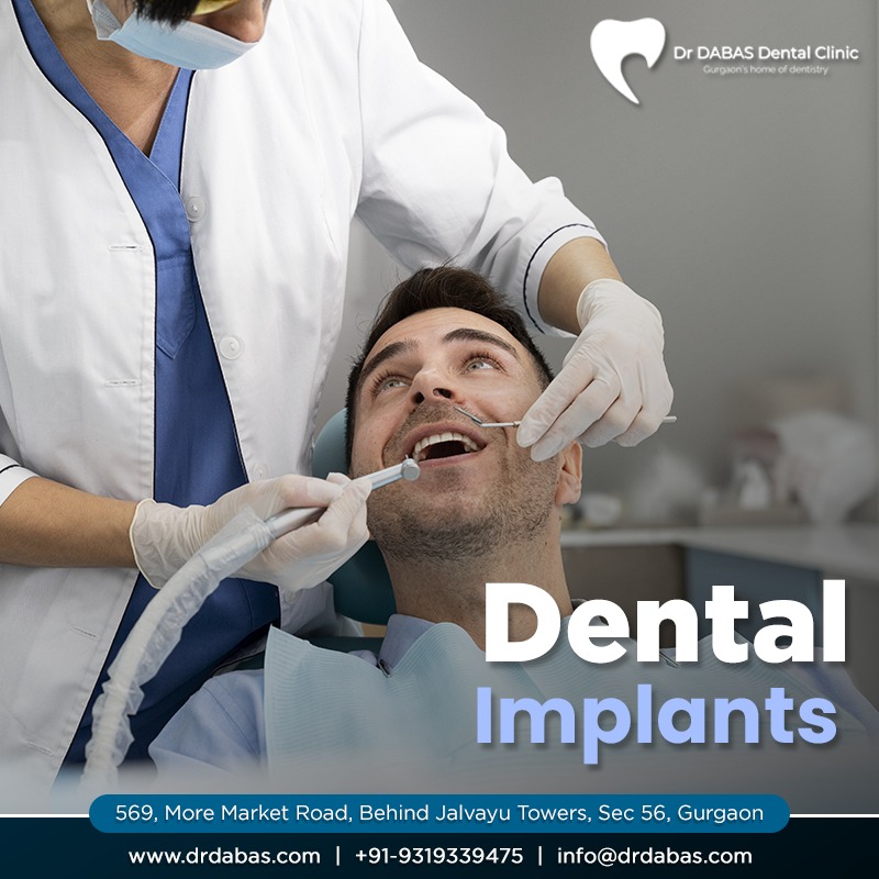 dental implant gurgaon