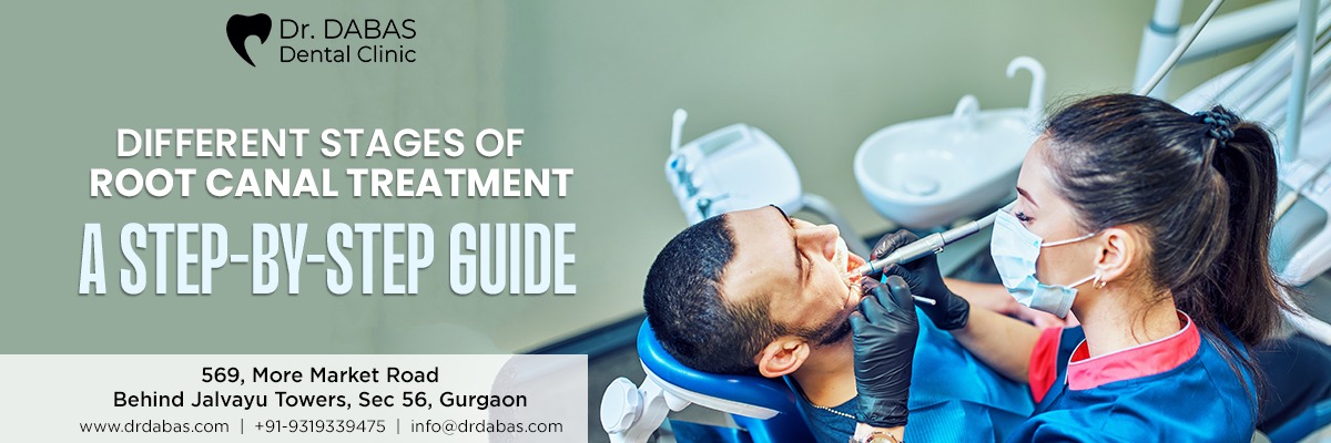 Root Canal Specialist In Gurgaon
