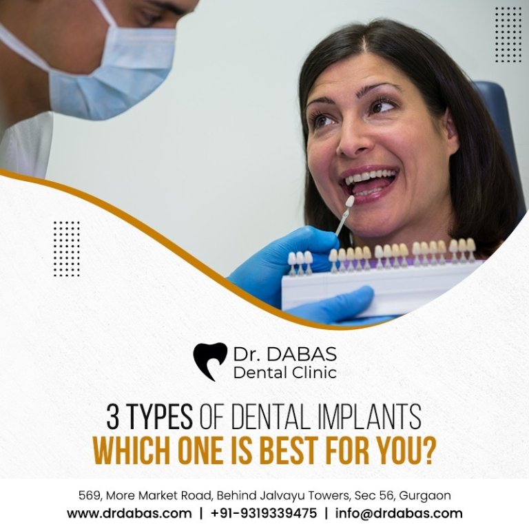 3 Types of Dental Implants Which One Is Best for You?