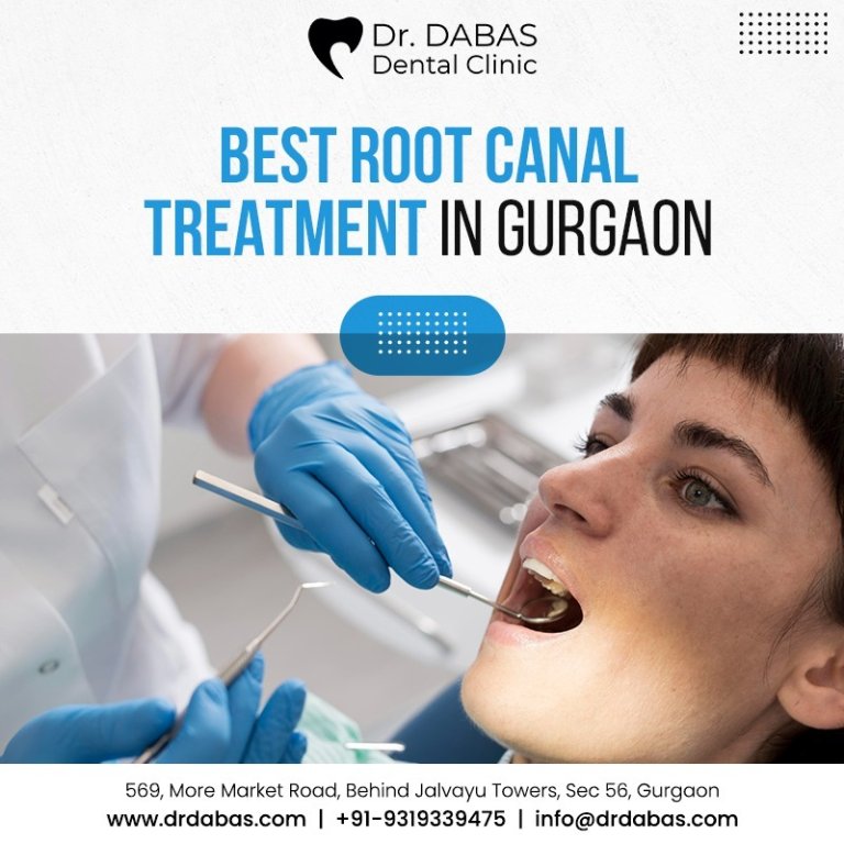 Best Root Canal Treatment in Gurgaon