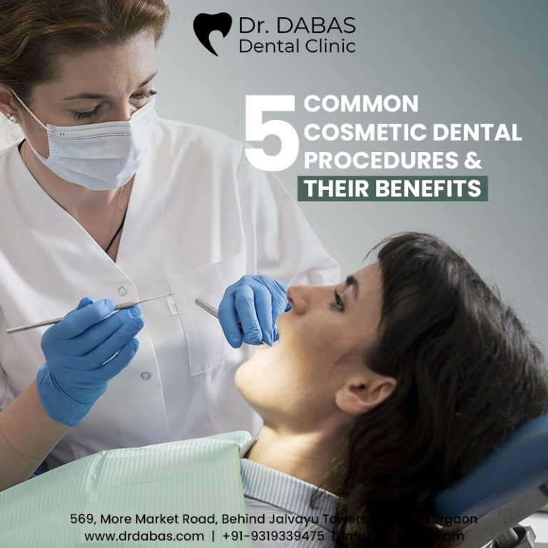 5 Common Cosmetic Dental Procedures and Their Benefits