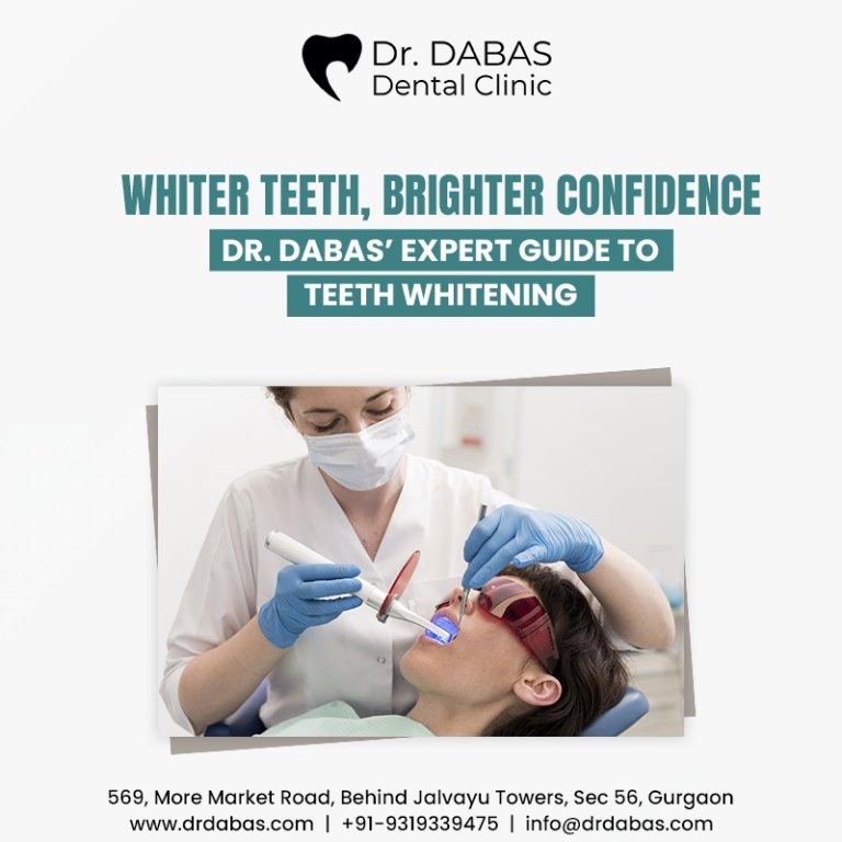 Whiter Teeth, Brighter Confidence: Dr. Dabas’ Expert Guide to Teeth Whitening