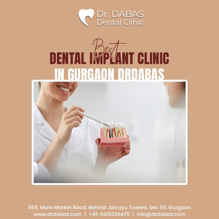 Best Dental Implant Clinic in Gurgaon -Drdabas