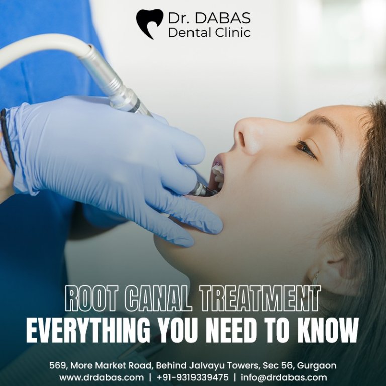 Root canal treatment- Everything you need to know