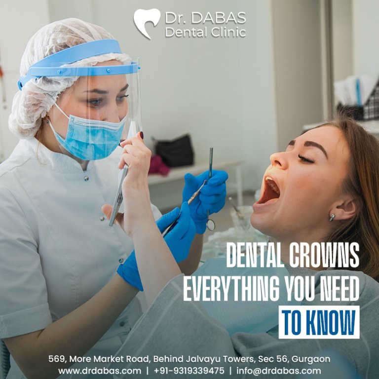 Dental Crowns: Everything You Need To Know