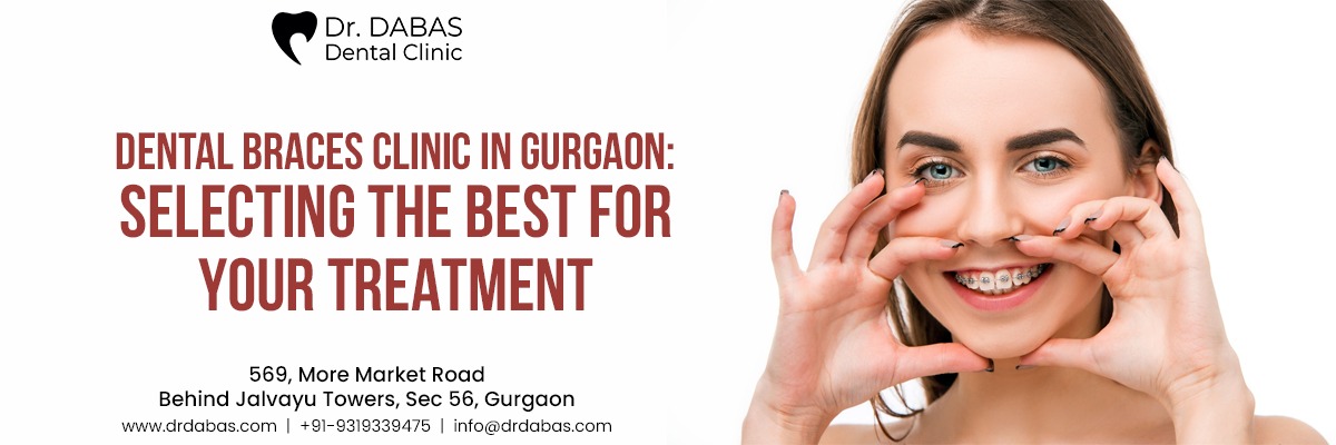 dеntal bracеs clinic in Gurgaon