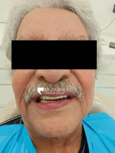 Dental Clinic in Gurgaon