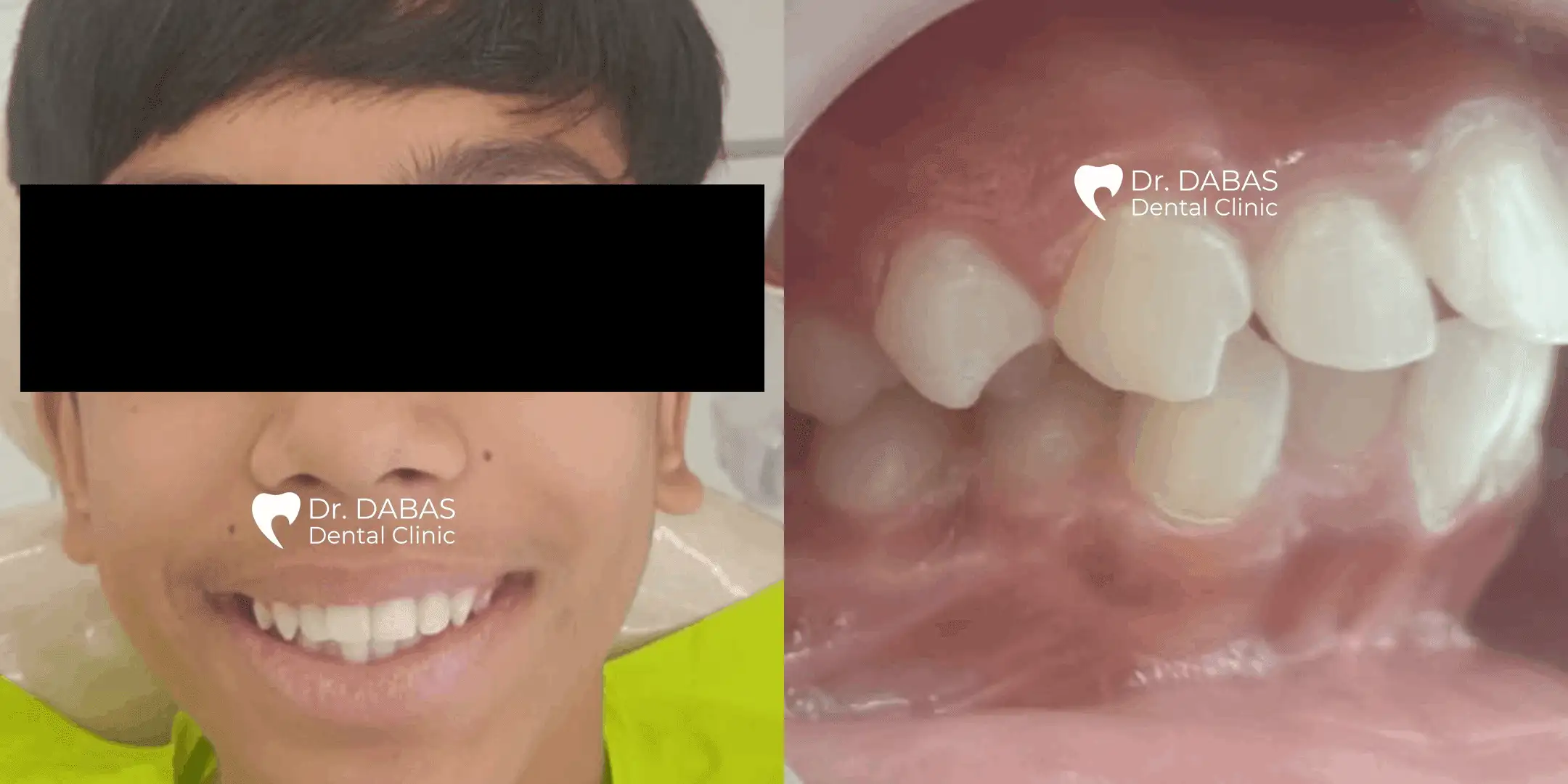 Top Dental Clinic in Gurgaon