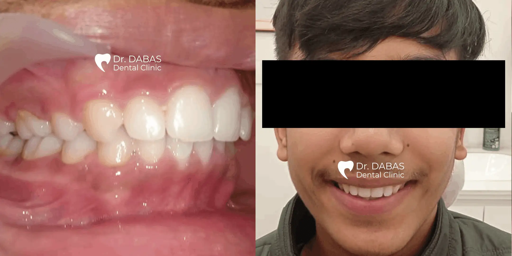 Dental Clinic in Gurgaon