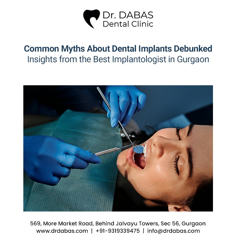 Common Myths About Dental Implants Debunked: Insights from the Best Implantologist in Gurgaon