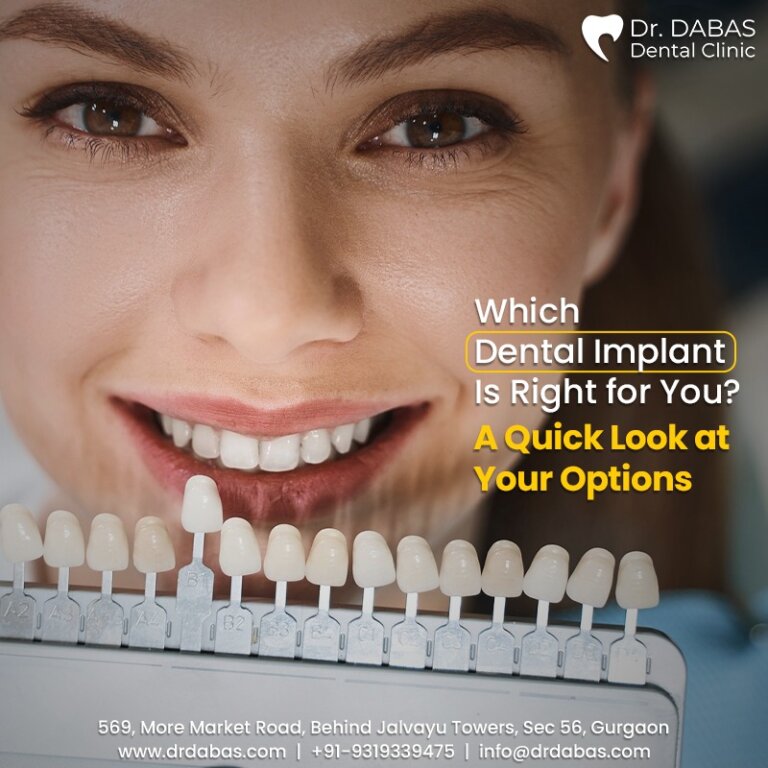 Full Mouth Dental Implants In Gurgaon