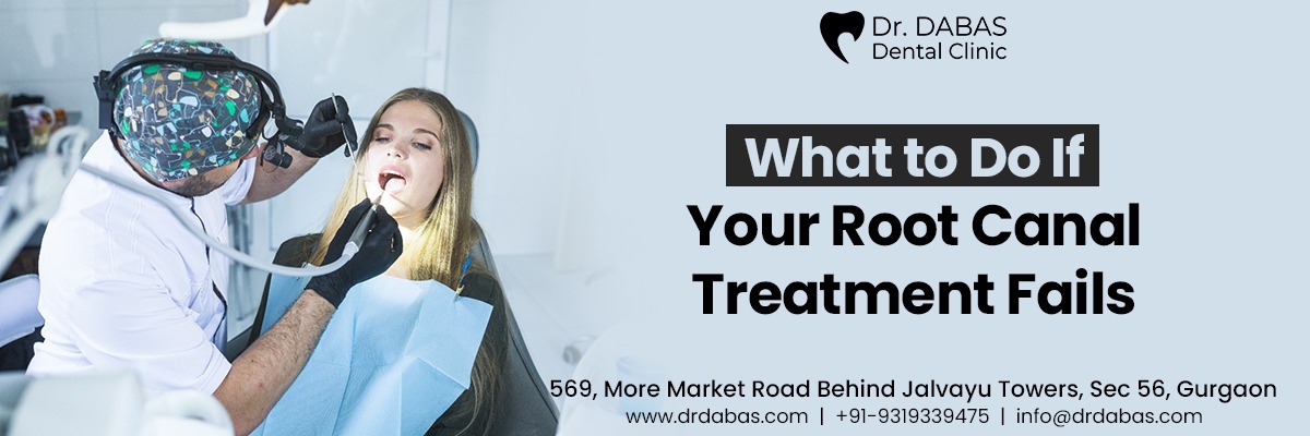 Root Canal Treatment in Gurgaon