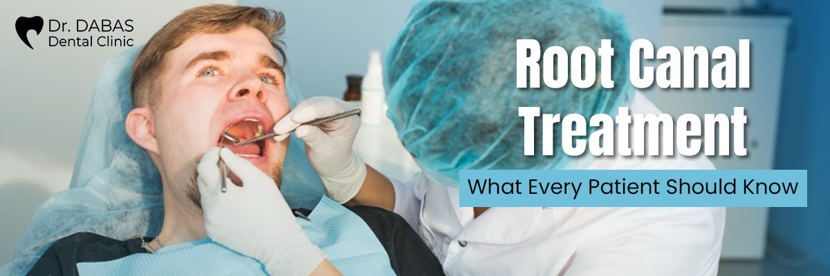 Root canal treatement