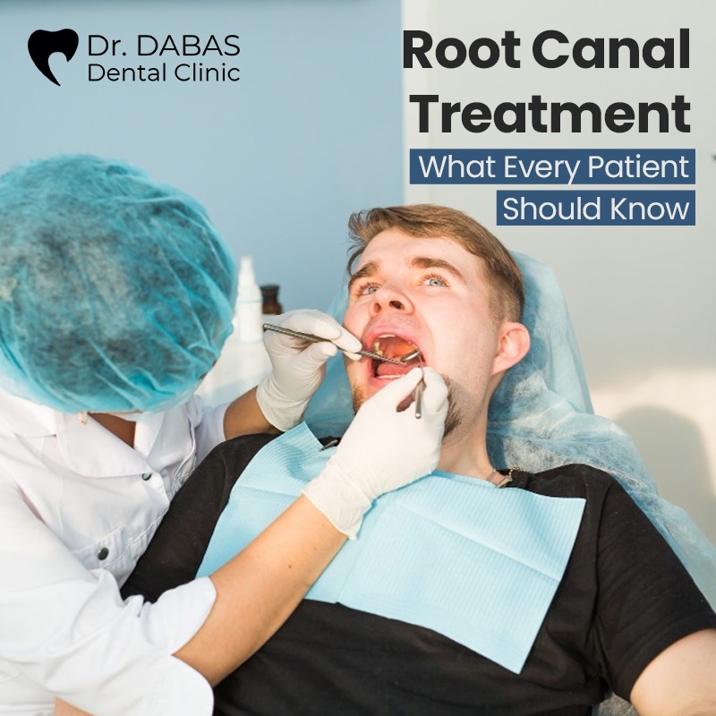 Root canal treatement in Delhi