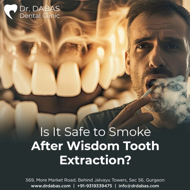 wisdom tooth extraction in Gurgaon