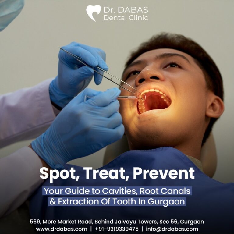 best root canal treatment in Gurgaon