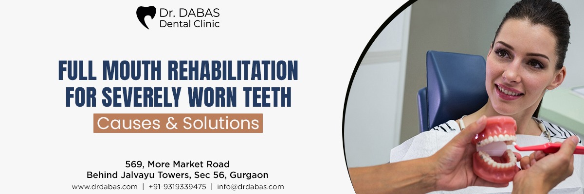 best root canal treatment in Gurgaon