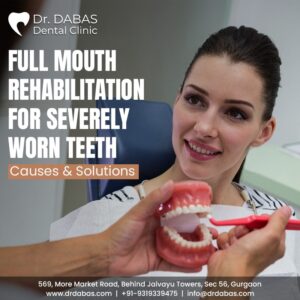 full mouth rehabilitation in Gurgaon