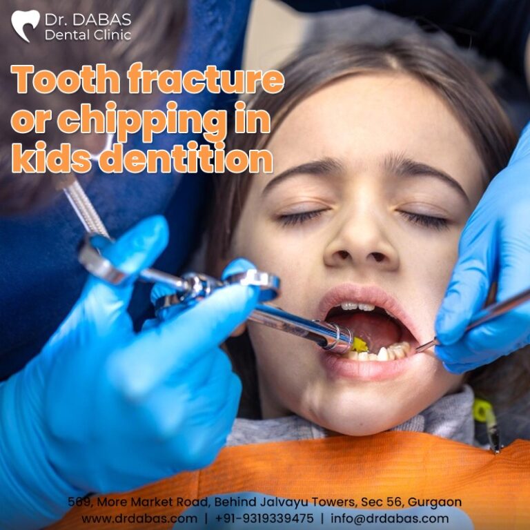 Tooth fracture or chipping in kids dentition