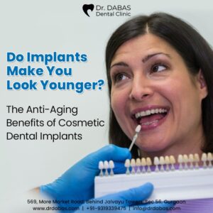 dental implant in Gurgaon