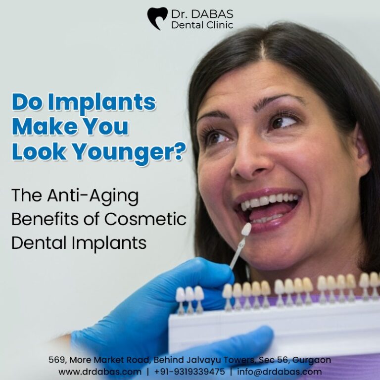 dental implant in Gurgaon