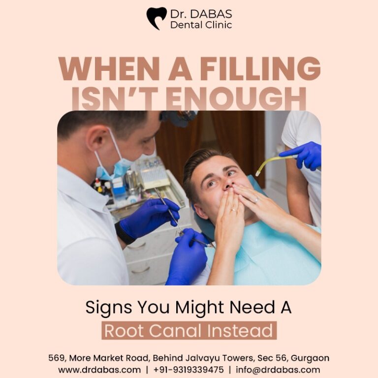 When a Filling Isn’t Enough: Signs You Might Need a Root Canal Instead