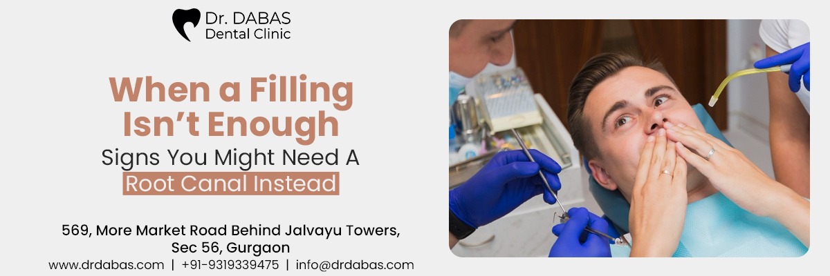 When a Filling Isn’t Enough: Signs You Might Need a Root Canal Instead