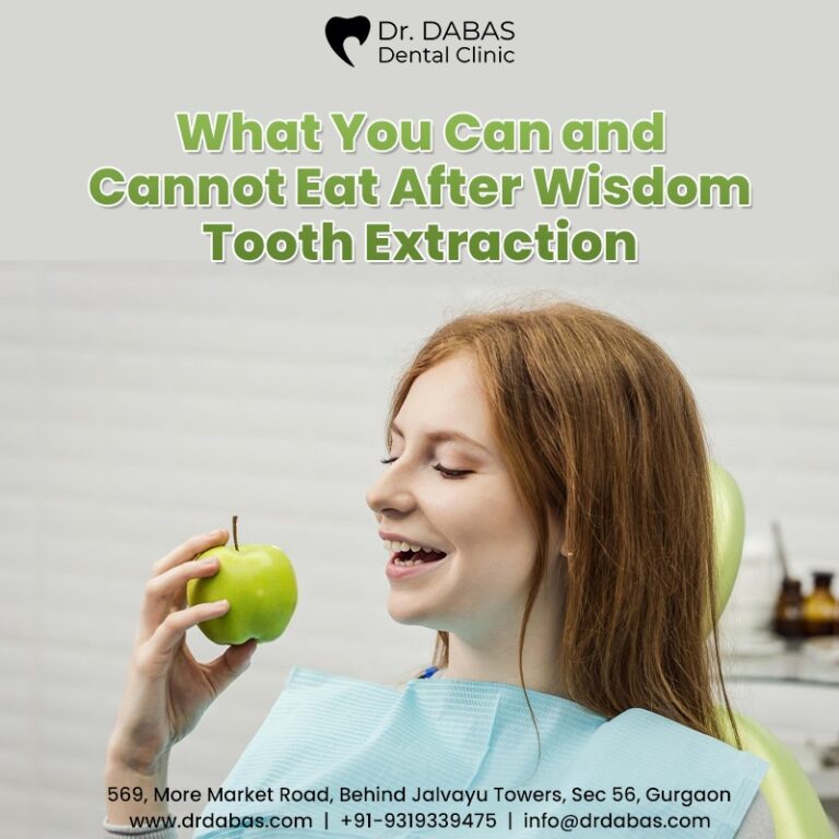 What You Can and Cannot Eat After Wisdom Tooth Extraction