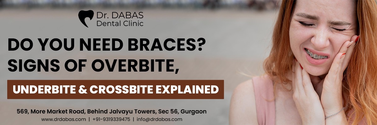 Do You Need Braces? Signs of Overbite,