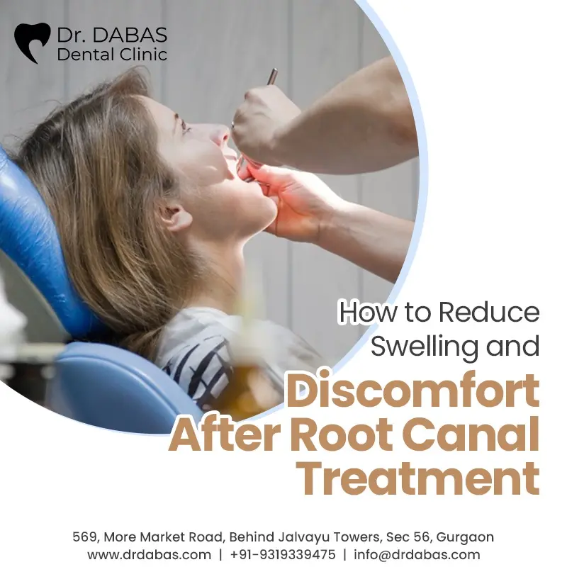 How to Reduce Swelling and Discomfort After Root Canal Treatment