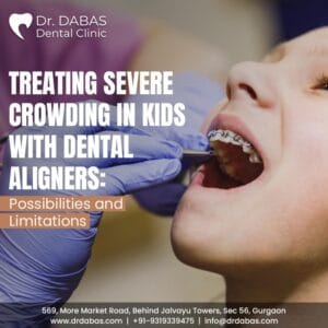 dental aligners for kids