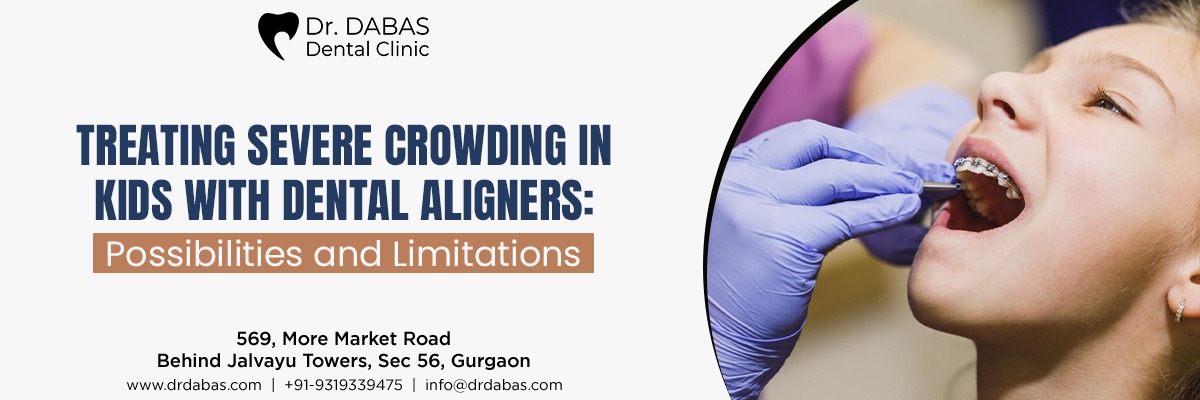 dental aligners for kids