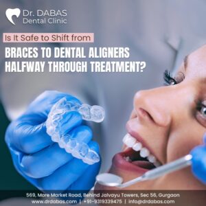 dental aligner