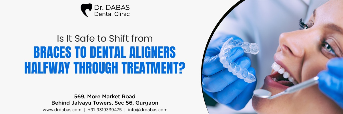 dental aligner