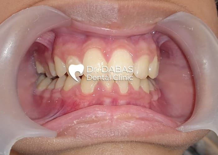 post case 1