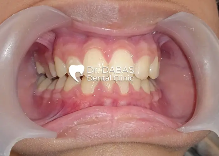 post case 1