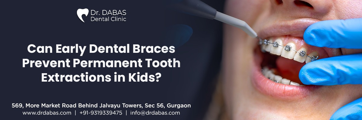 Can Early Dental Braces Prevent Permanent Tooth Extractions in Kids?