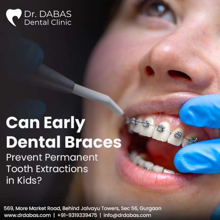 Can Early Dental Braces Prevent Permanent Tooth Extractions in Kids?