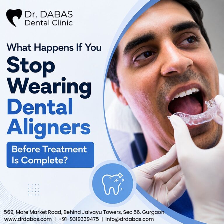 teeth aligner clinics in Gurgaon
