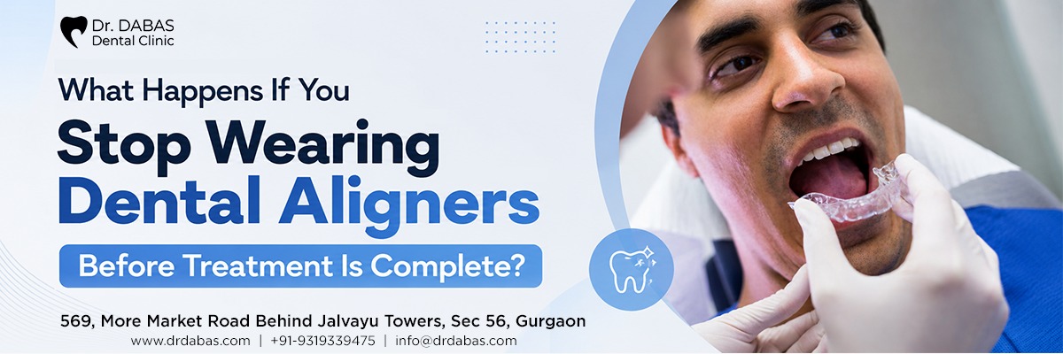 teeth aligner clinics in Gurgaon