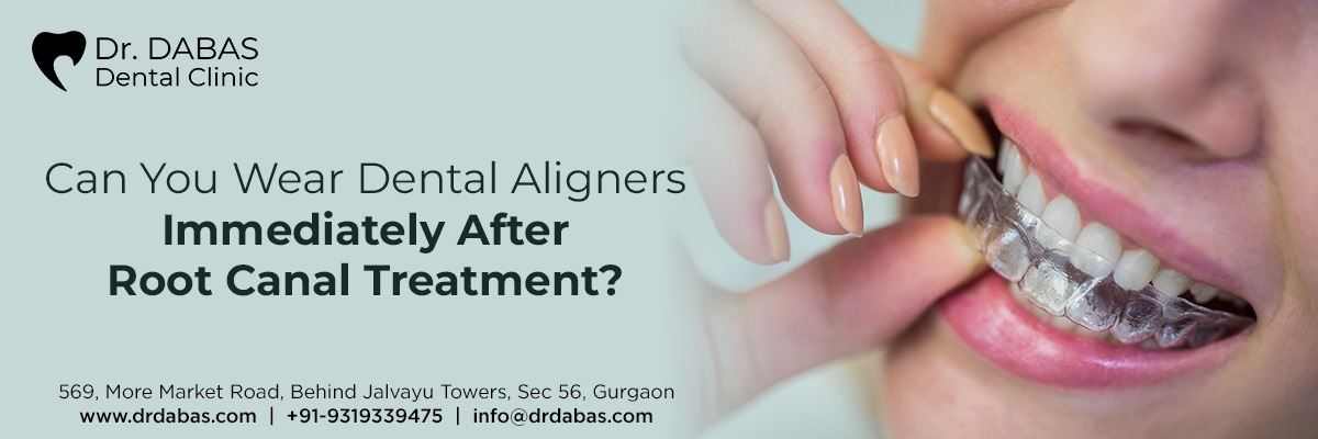 Dental Aligners