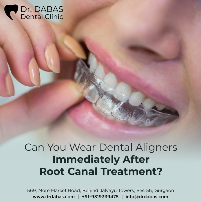 Dental Aligners