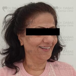 Dental Implants Clinic in Gurgaon