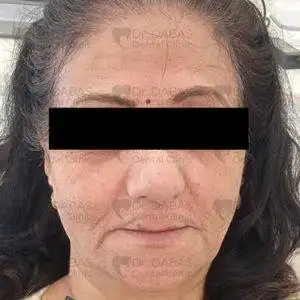 Best Dental Implants Clinic in Gurgaon Sector 56